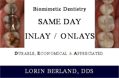 Same Day Inlay / Onlays