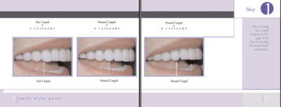 teeth shaping