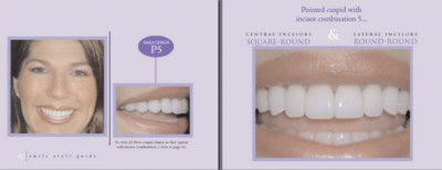 teeth shaping